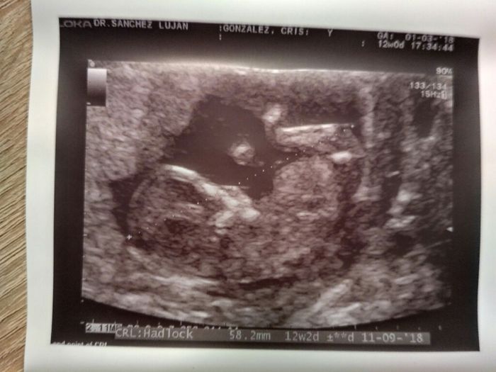 Nuevo! Futuras mamas Septiembre 2018 - 3