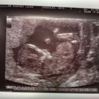 Nuevo! Futuras mamas Septiembre 2018 - 3