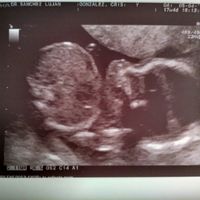 Nuevo! Futuras mamas Septiembre 2018 - 2