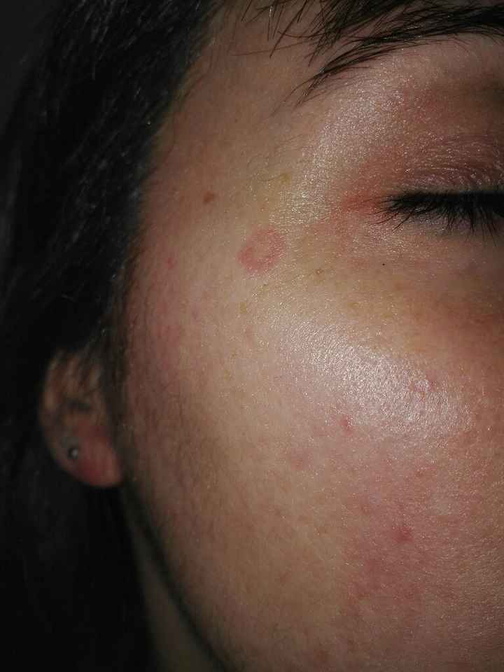 Necesito opiniones. posible alergia - 1
