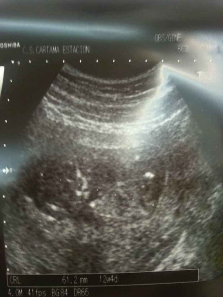 Mamis enero 2016 - 1