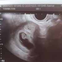 Ayuda con método ramzi: niño o niña? - 1