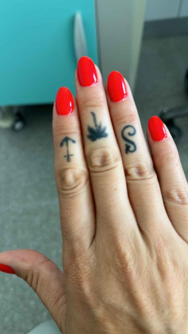 Eliminar un tatuaje - 1