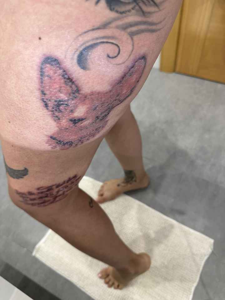 Eliminar un tatuaje - 3