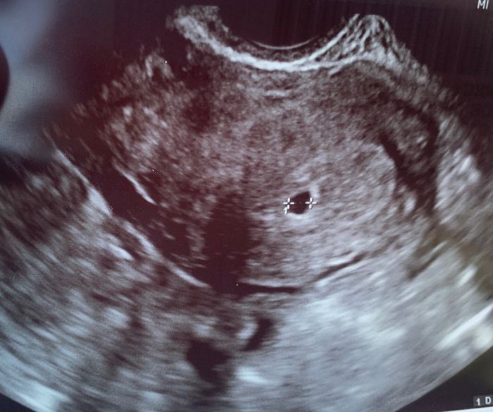 Futuras mamás Mayo 2021🤰♥️ - 1