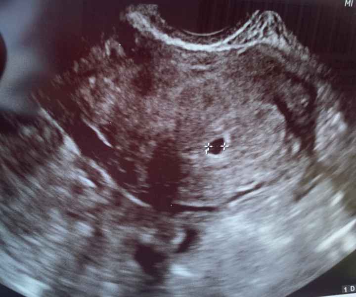 Futuras mamás Mayo 2021🤰♥️ - 1