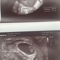 Futuras mamás Mayo 2021🤰♥️ - 1