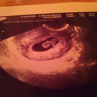 Ayuda con método ramzi: niño o niña? - 1
