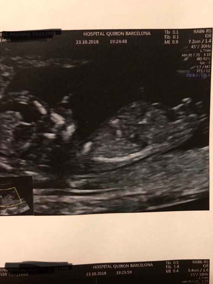12 semanas