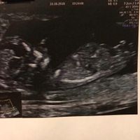 12 semanas