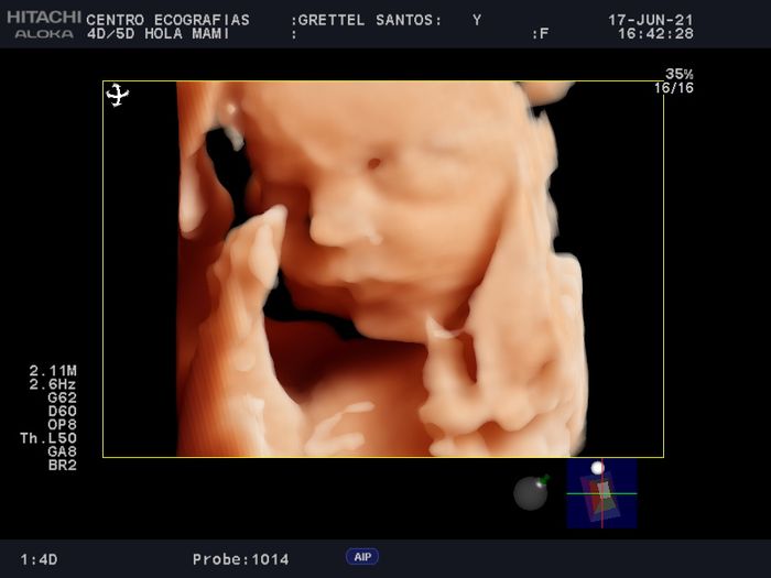 Futuras mamas septiembre 2021🤰🤱 - 1
