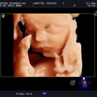 Futuras mamas septiembre 2021🤰🤱 - 1
