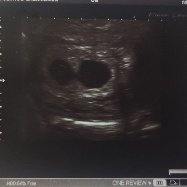 💞 Futuras Mamis marzo 22 🤰🏼 - 1