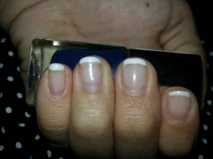 Uñas totalmente destrozadas!!! - 1