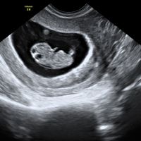 Mamis Octubre 2019 - 1