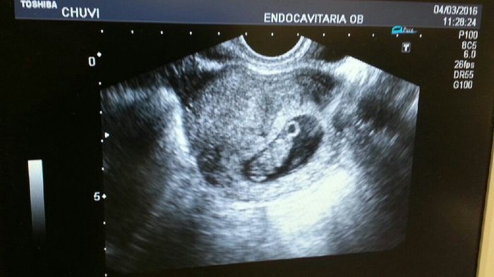 Futuras mamis octubre 2016 - 1
