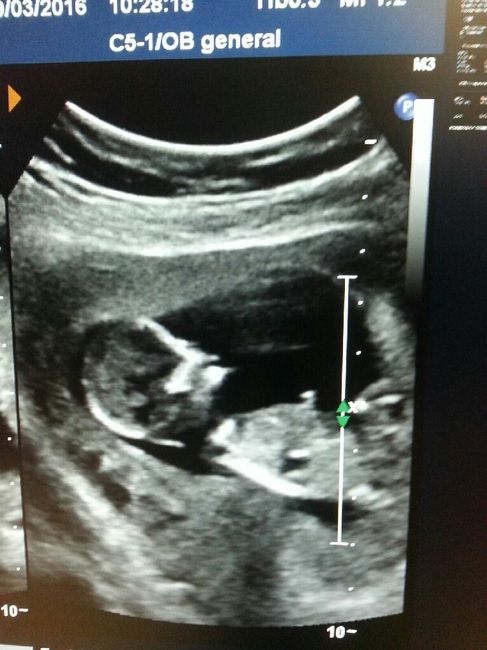Futuras mamis octubre 2016 - 1