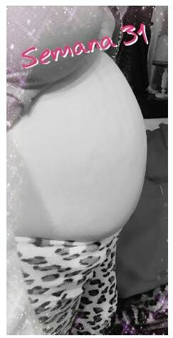 31 semana de embarazo