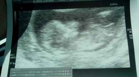 mi bebe 11 5
