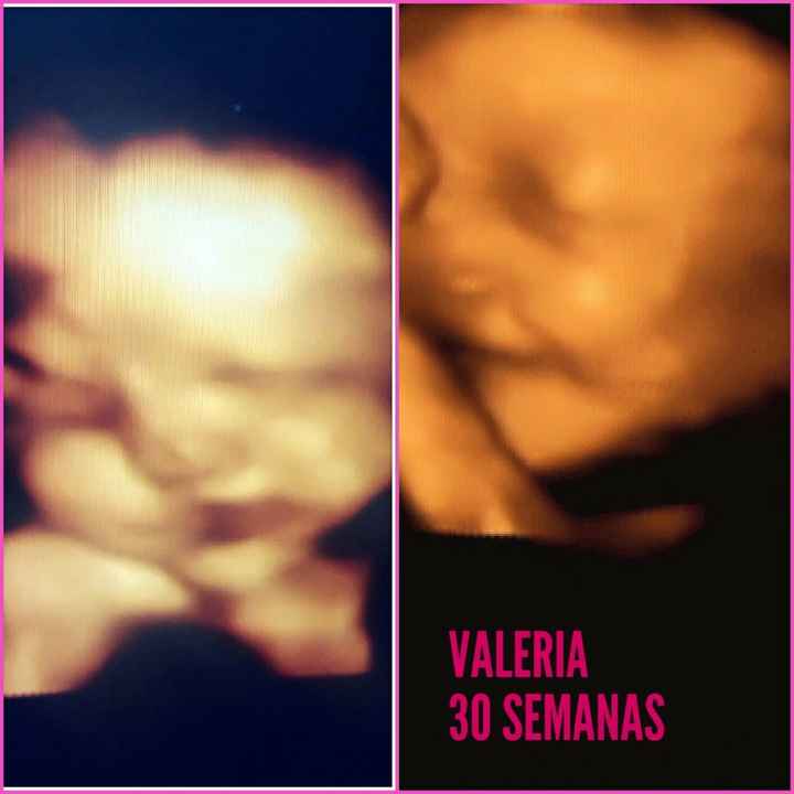 VALERIA 30 semanas