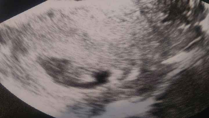 Mamis de junio 2017 - 1