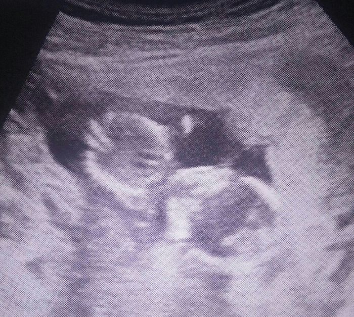 Mamis de junio 2017 - 1