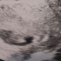 Mamis de junio 2017 - 1