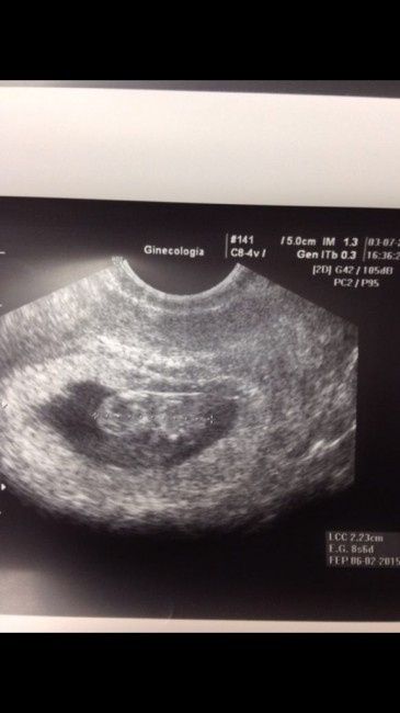 Mamas Febrero 2015 - 1