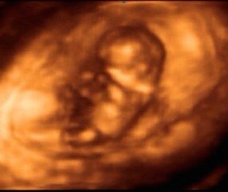11 semanas 3d