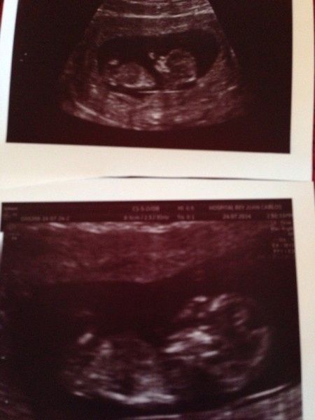Mamas Febrero 2015 - 1