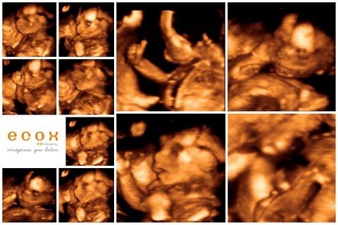 Mamas Febrero 2015 - 2