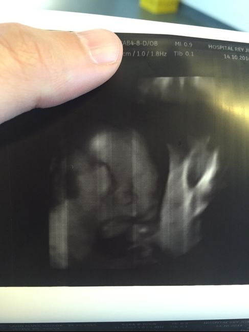 24 semanas