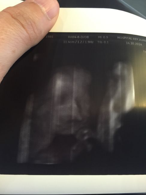 24 semanas