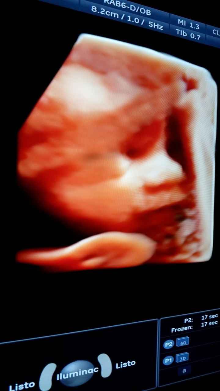 Lucía 28+2 semanas