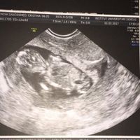 Mamis septiembre 2017 - 2