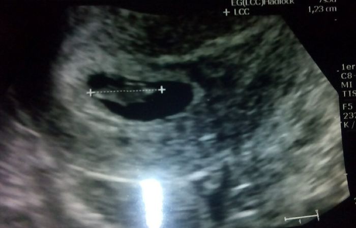 Futuras mamás junio 2016 - 1