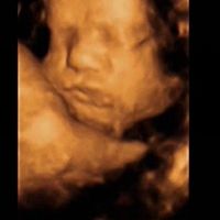 ¡futuras mamis noviembre 2016! - 1