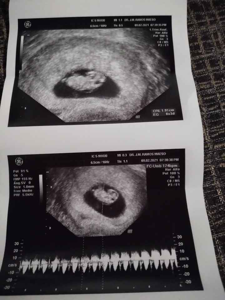 Futuras mamas septiembre 2021🤰🤱 - 1