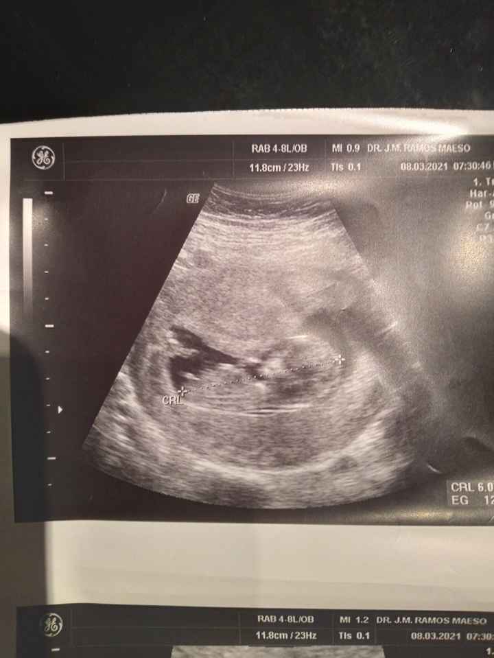 Futuras mamas septiembre 2021🤰🤱 - 1