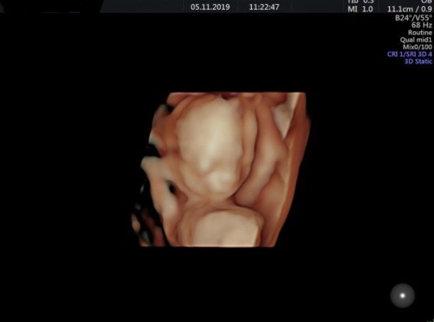 Mamis Abril 2020 (nuevo) - 2