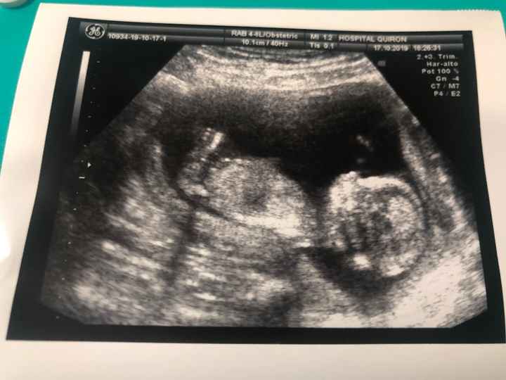 13 semanas