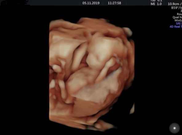 Mamis Abril 2020 (nuevo) - 1
