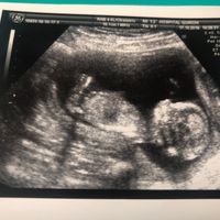13 semanas