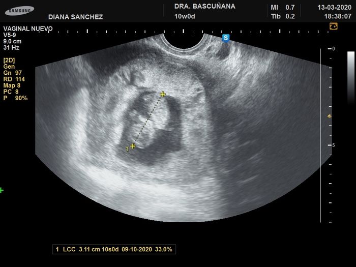 Futuras mamas octubre 2020 - 1