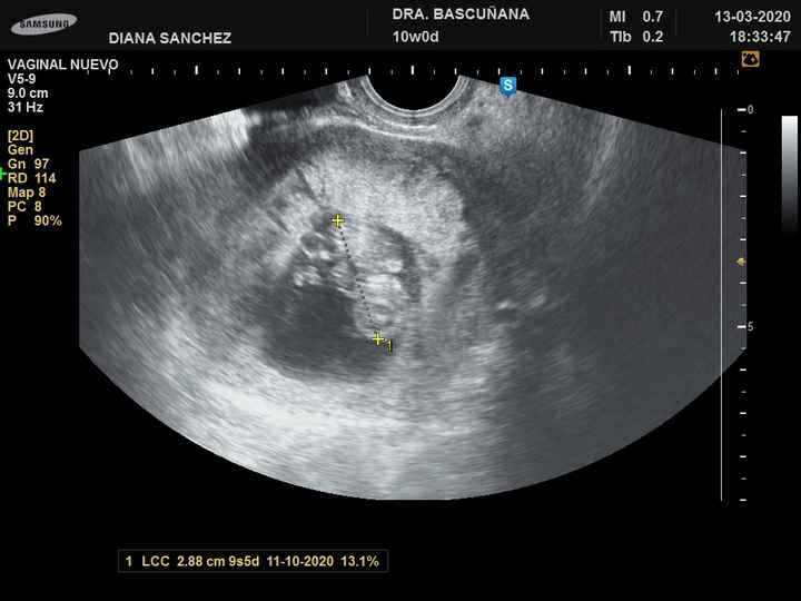 Futuras mamas octubre 2020 - 1