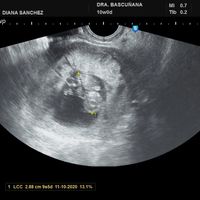 Futuras mamas octubre 2020 - 1