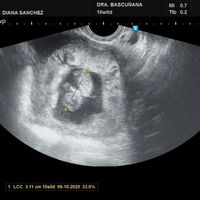 Futuras mamas octubre 2020 - 1