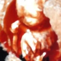 Futuras mamas octubre 2020 - 1