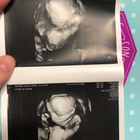 Futuras mamas octubre 2020 - 1