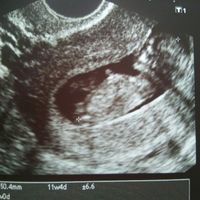 Nuevo! futuras mamis noviembre 2017 - 1